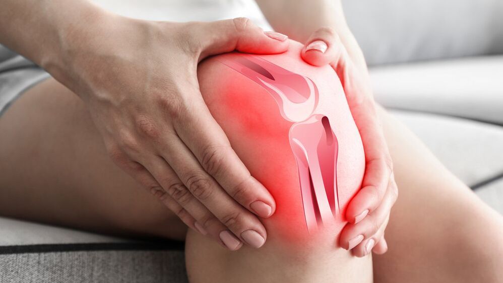 Liečba bolesti kĺbov Osteflex