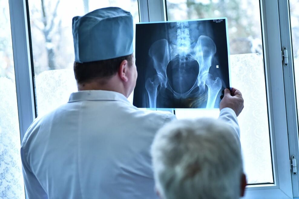 Lekár sa pozerá na obrázok bedrového kĺbu s artrózou